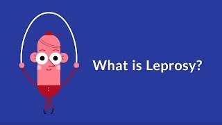 What is Leprosy Chronic Infectious Disease [upl. by Einaled722]