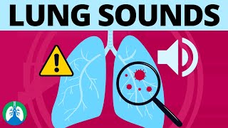 S1 Heart Sound  Learn How to Auscultate Part 8 [upl. by Karita]