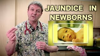 Jaundice in Newborns Pediatric Advice [upl. by Caswell]