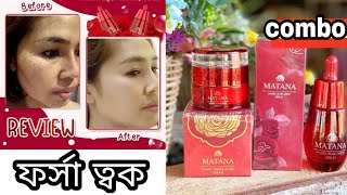 matana whitening combo  matana serum amp matana night cream review  khadija begum bhb tips Shajgoj [upl. by Ahsaf]