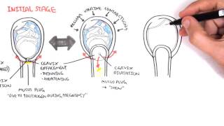 Obstetrics  Stage I of Labour [upl. by Easter]