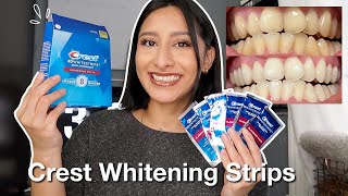 I TRIED THE CREST 3D WHITESTRIPS FOR 14 DAYS Effective  Before amp After pictures [upl. by Ahsienyt]