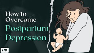 Postpartum Depression [upl. by Morgan955]