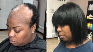 Custom Made Bob Wig  Shaved Clients Head Psoriasis amp Mild Alopecia Tutorial [upl. by Ovid]