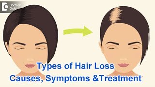 Types of Hair Loss  Common Causes Symptoms amp Treatment  Dr Kavitha GV Mandal [upl. by Ellis976]