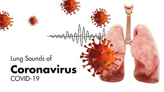 Sounds of Coronavirus COVID19  Lung Sounds [upl. by Sewellyn426]