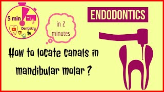 Mandibular first molar  access opening  Endodontics  RCT  easy tips [upl. by Safoelc]