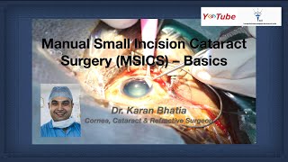 Cataract Surgery  Inside the OR [upl. by Aggarwal]