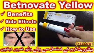 Betnovate Yellow cream Uses benefits and side effectshow to use Betnovate N Onitiment cream [upl. by Norramic719]