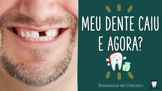 Meu Dente caiu e agora O que fazer [upl. by Karp]