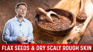 Flaxseed Benefits for Skin amp Symptoms of Linoleic Acid Deficiency – Dr Berg [upl. by Spanos]