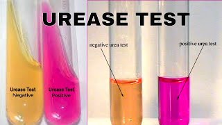 Urea Hydrolysis Urease Test [upl. by Jennine815]