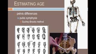 Forensic Anthropology Identifying individuals [upl. by Hiltner]