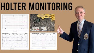 Holter Testing upto 14 Days of Recording [upl. by Anaahs]