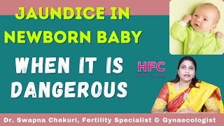 Jaundice In New Born Babies  Symptoms amp Treatment  Dr Swapna Chekuri  HFC [upl. by Ednyl559]