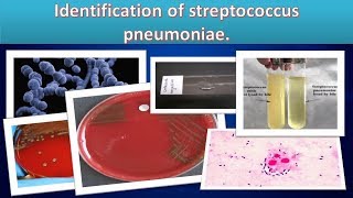 Identification of SpneumoniaeSimpleclear overview [upl. by Peirce453]