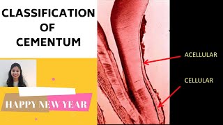 CEMENTUM  PART II II Classification of Cementum [upl. by Asiuqram741]