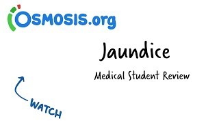 Jaundice  Clinical Presentation [upl. by Drucy215]