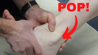 Peroneus longus subluxation How to treat it [upl. by Boff]