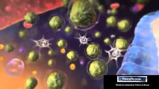 Acute Lymphocytic Leukemia ALL Animation [upl. by Sedgewake]