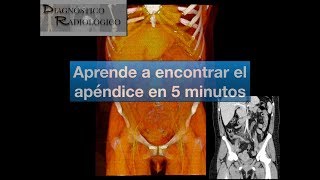 Aprende como encontrar el apéndice en 5 minutos [upl. by Jenn]