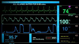 Sonido De Un Hospital [upl. by Enilesoj]