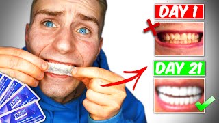 Crest 3D White Strips Do They Work 21 day challenge [upl. by Nehr]