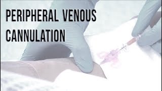 Peripheral Venous Cannulation [upl. by Eelloh]