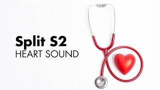 Fixed Split S2  Heart Sounds  MEDZCOOL [upl. by Anigar]