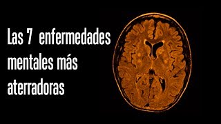 Las 7 enfermedades mentales más aterradoras [upl. by Chesna]