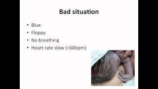 Paediatrics  neonatal resuscitation [upl. by Chemarin]