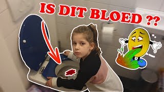 quotMAMA IK HEB BLOED GESPUUGDquot KOETLIFE VLOG [upl. by Jaimie461]