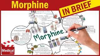 Morphine Maracex Oramorph Sendolor What is Morphine Used For Uses Dosage amp Side effects [upl. by Aerb]