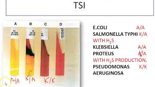 BIOCHEMICAL TEST FOR GRAM NEGATIVE BACILLI part 2 [upl. by Rodolphe]