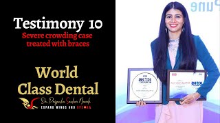 Premolar extraction along with ceramic braces  Dr Priyanka  World Class Dental [upl. by Larimer]