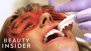 The Fastest Way Dentists Whiten Teeth  Beauty Explorers  Beauty Insider [upl. by Ocirne]