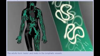 Lymphatic Filariasis Elephantiasis  Life Cycle [upl. by Blim639]