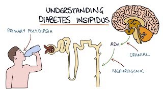 Understanding Diabetes Insipidus [upl. by Terrena]