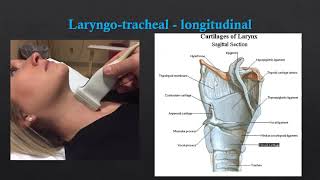 Neck US  Basic Anatomy [upl. by Ruhnke]