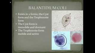 Parasitology Balantidiasis Part 2 [upl. by Eneluj]