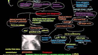 Respiratory Distress in neonates 2 meconium aspiration syndrome [upl. by Ordnazil]