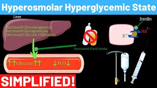 Hyperosmolar Hyperglycemic Nonketotic Syndrome  Panmedicad [upl. by Dnar594]