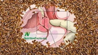 Flaxseed vs Prostate Cancer [upl. by Viens]