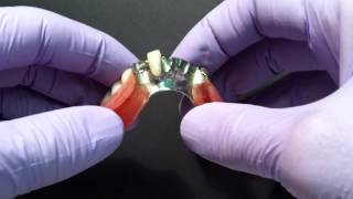 Soft Lining for Partial Dentures [upl. by Omik468]