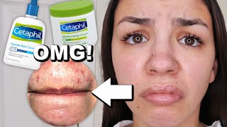 I Used Cetaphil Skincare For One Week [upl. by Treulich]