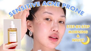 Korean Skincare for Acne Prone Skin WHOLE ROUTINE [upl. by Hgielsel]