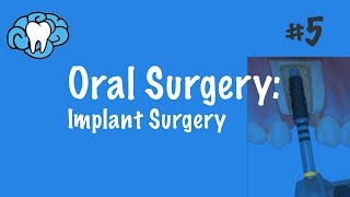 Oral Surgery  Implants  INBDE ADAT [upl. by Donia837]