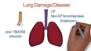 Mycobacterium avium complex  causes symptoms diagnosis treatment pathology [upl. by Ahsikam802]