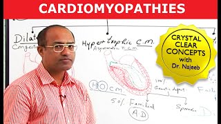 Dilated cardiomyopathy DCM causes symptoms diagnosis treatment amp pathology [upl. by Bealle618]