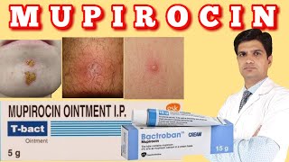 T bact ointment  Bactroban ointment  Mupirocin ointment uses side effects how to apply [upl. by Asilanna999]